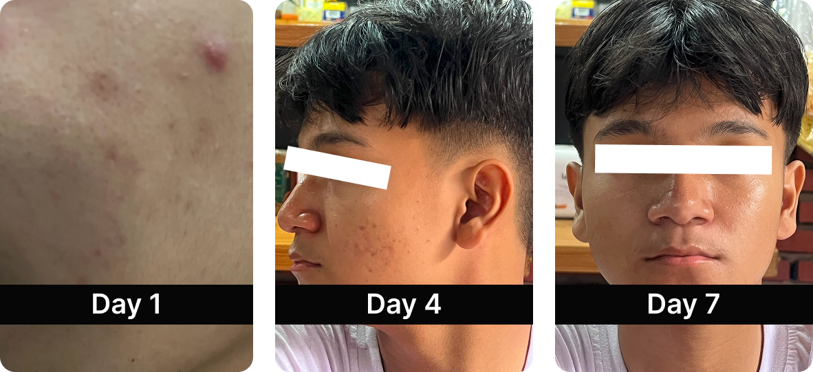 Before After Results